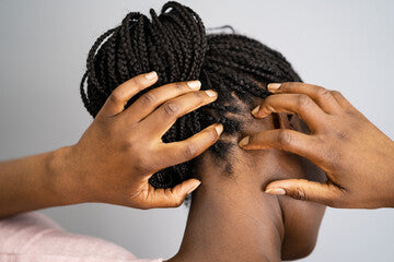 Common Scalp Conditions: Causes, Symptoms, and Treatments